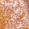 Pink Gold - PP44
